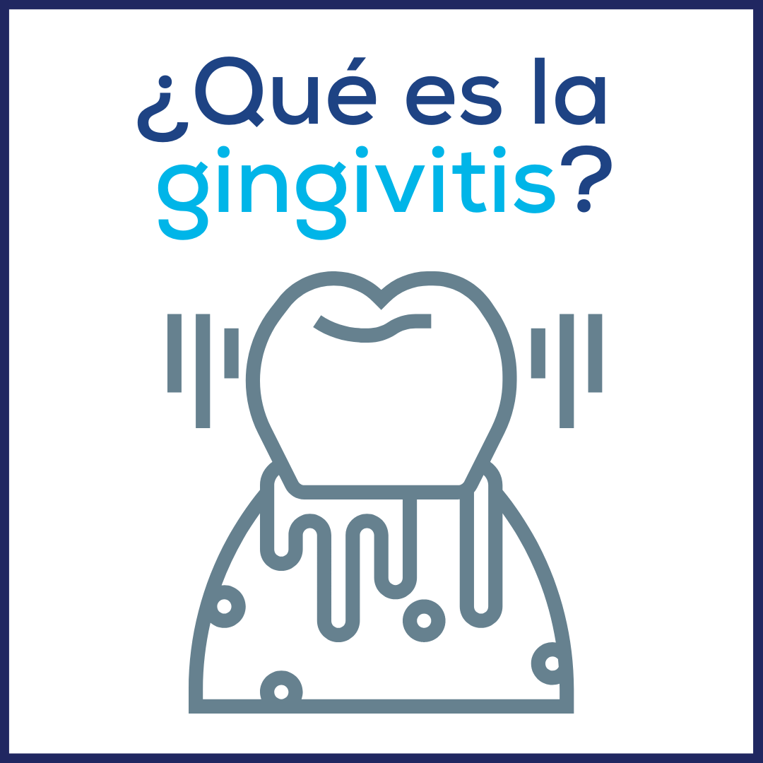 ¿Qué es la gingivitis? signos, síntomas, causas y tratamiento