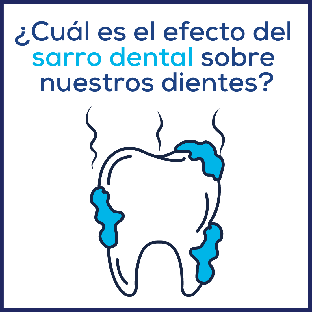 Sarro o cálculo dental :: ¿Qué es? ¿Cuáles son sus efectos? y ¿Cómo eliminarlo?
