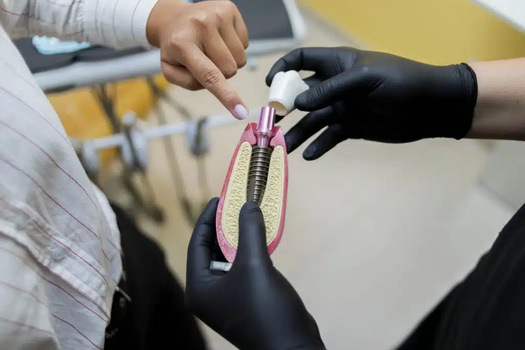 Foto de Implante dental en Lima Especialista en periodoncia e implantología oral 
