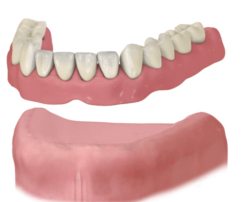 Prótesis dental total Clínica de encías Lima