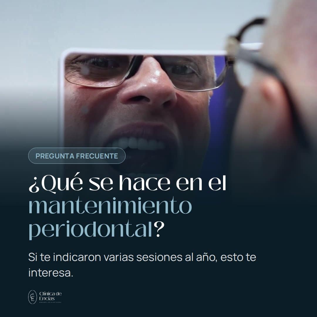 ¿Qué se hace en el mantenimiento periodontal?
