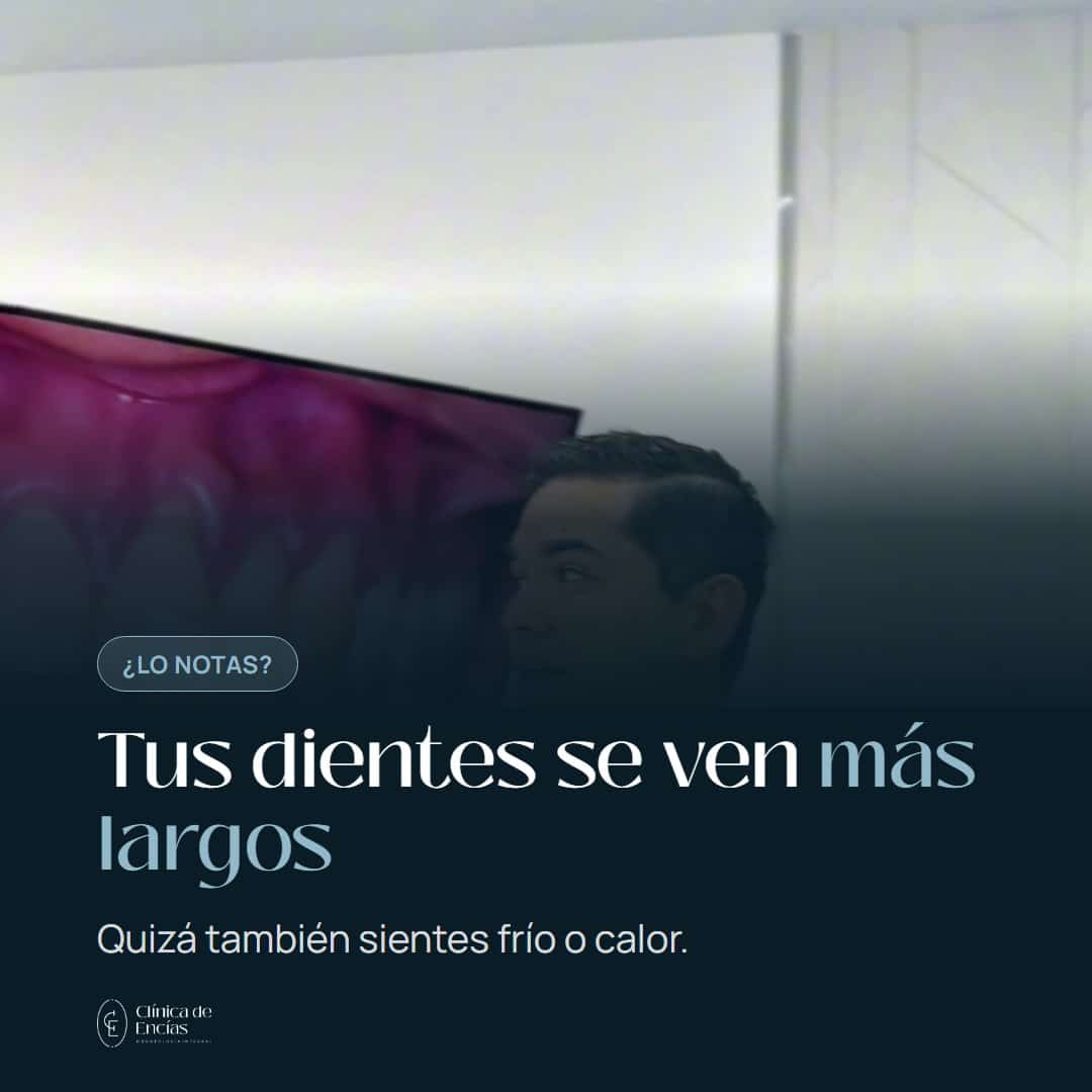 Retracción de encías: por qué tus dientes se ven más largos