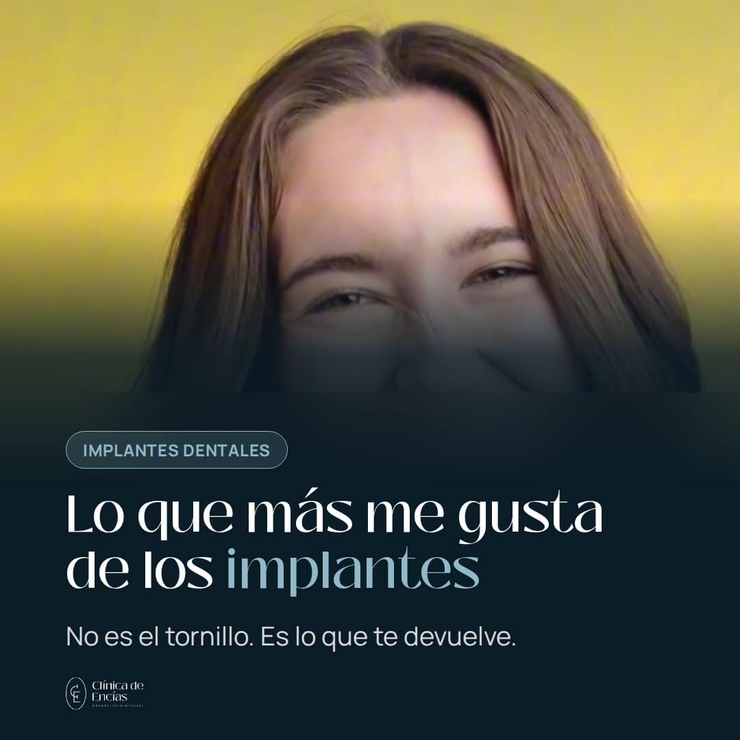 Lo que más me gusta de los implantes dentales