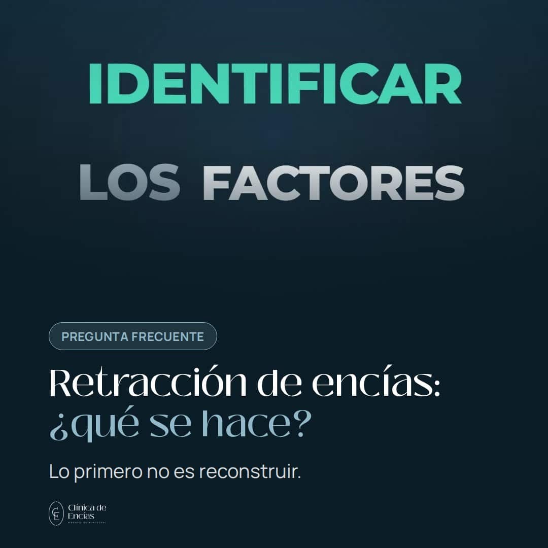 Retracción de encías: ¿qué se hace?