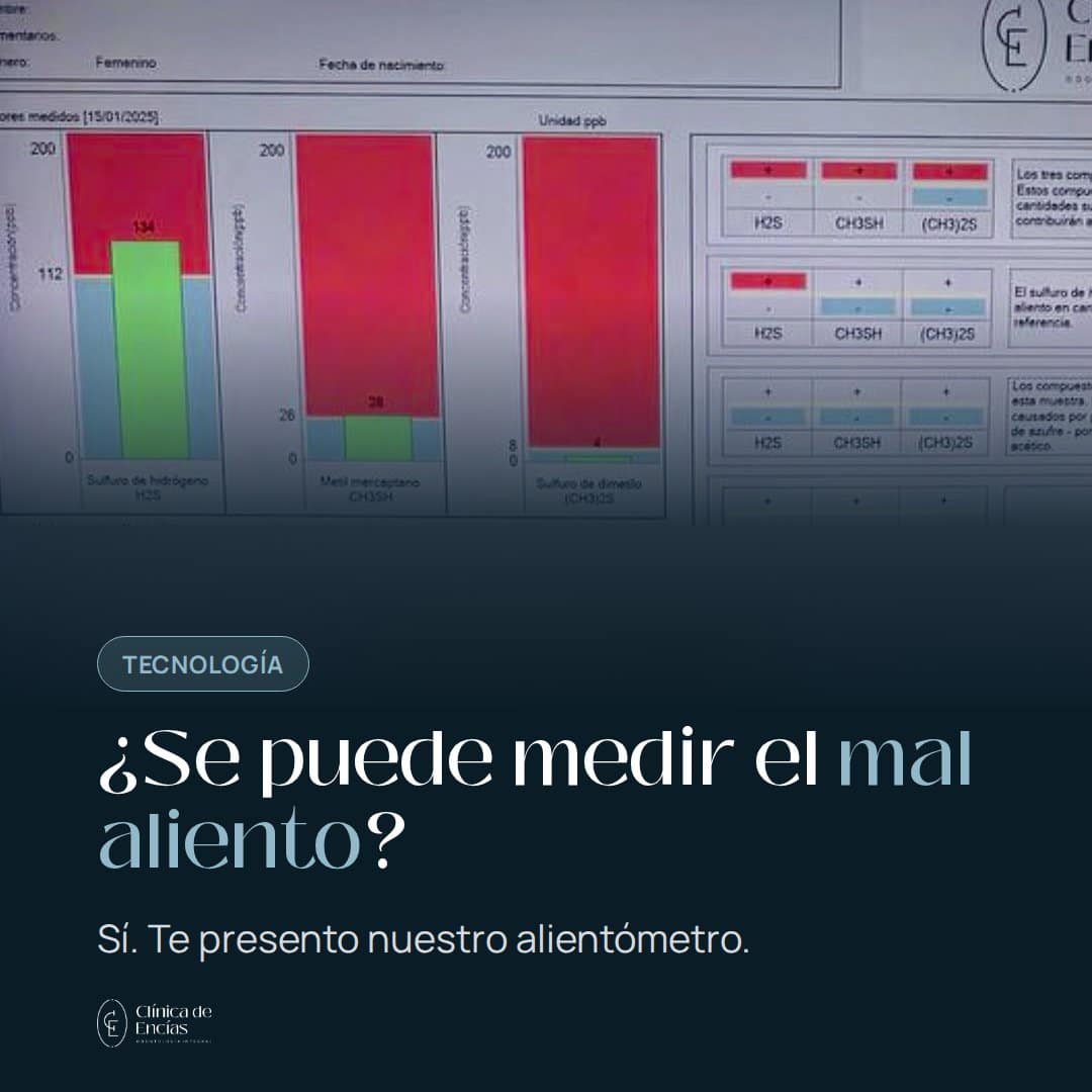 ¿Se puede medir el mal aliento? Así funciona el alientómetro