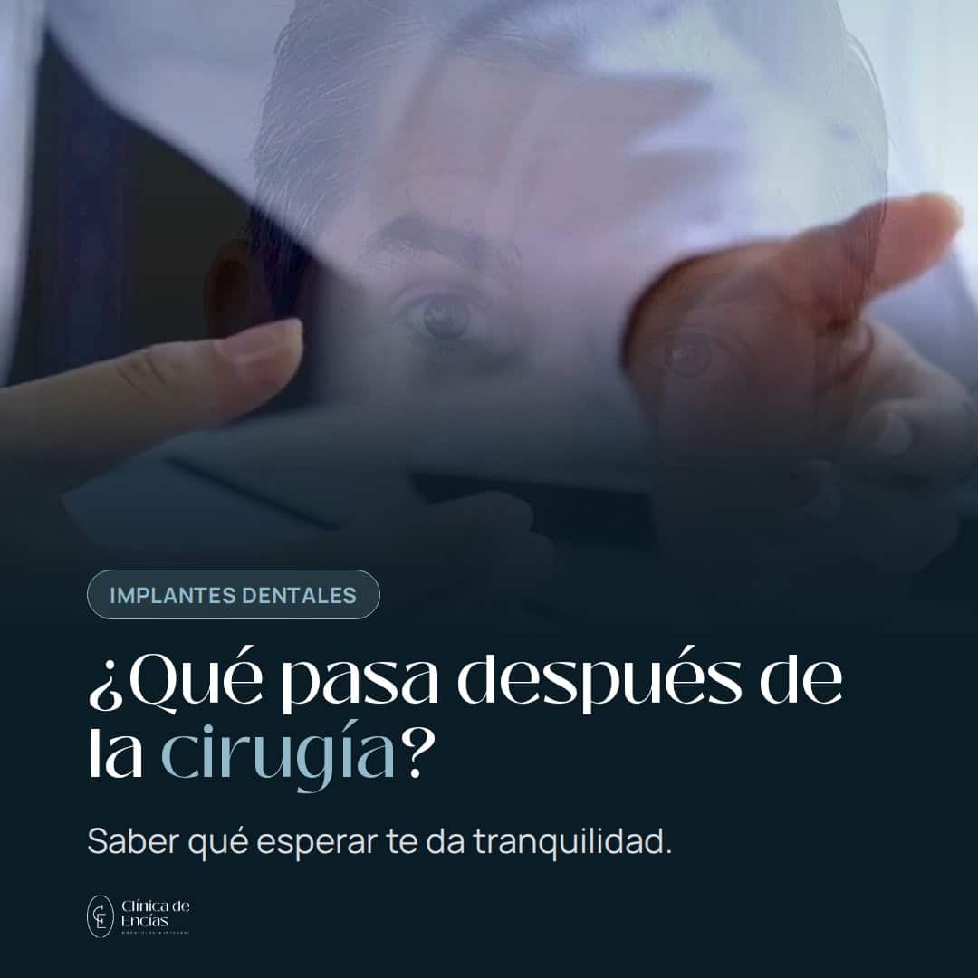 ¿Qué pasa después de la cirugía del implante?