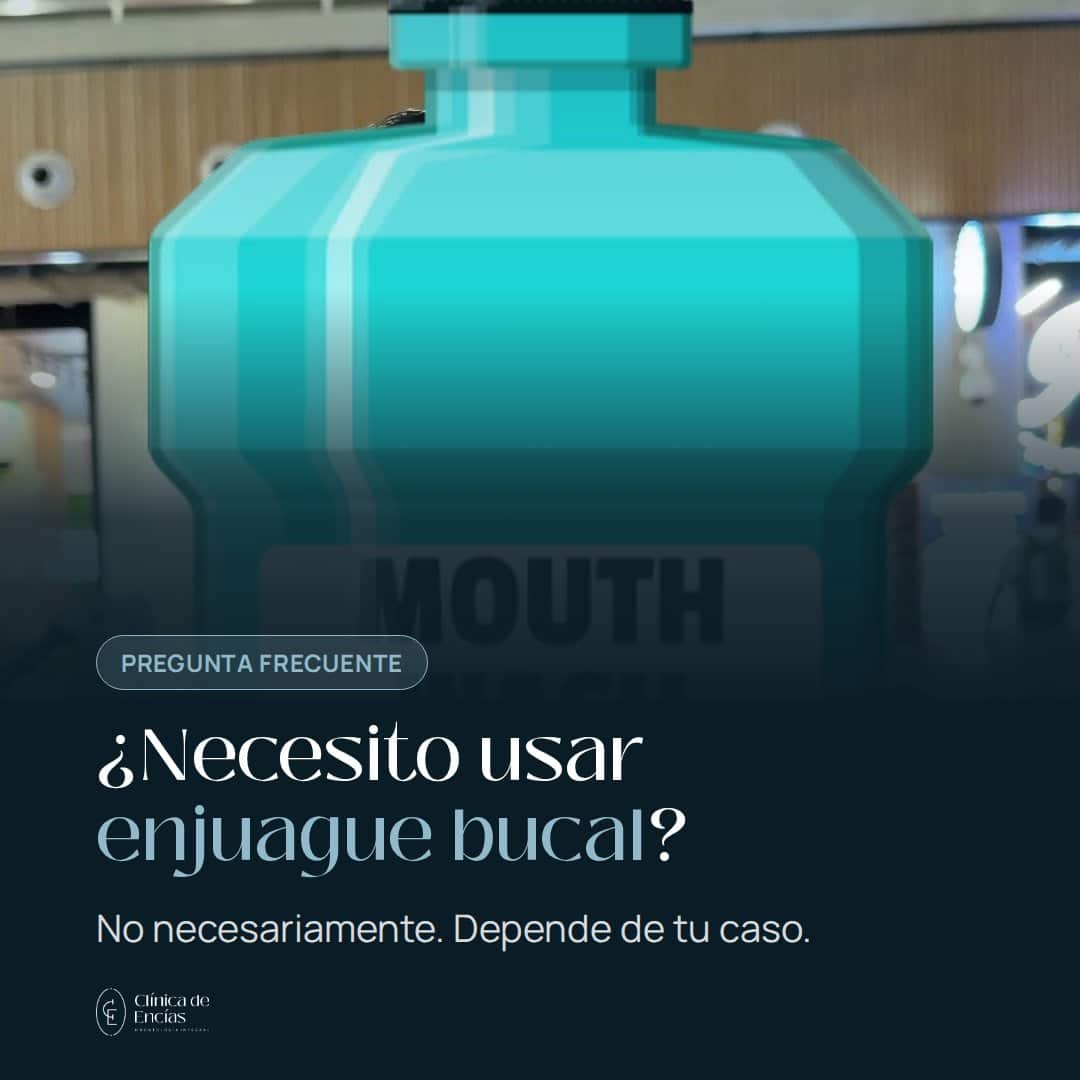 ¿Necesito usar enjuague bucal?