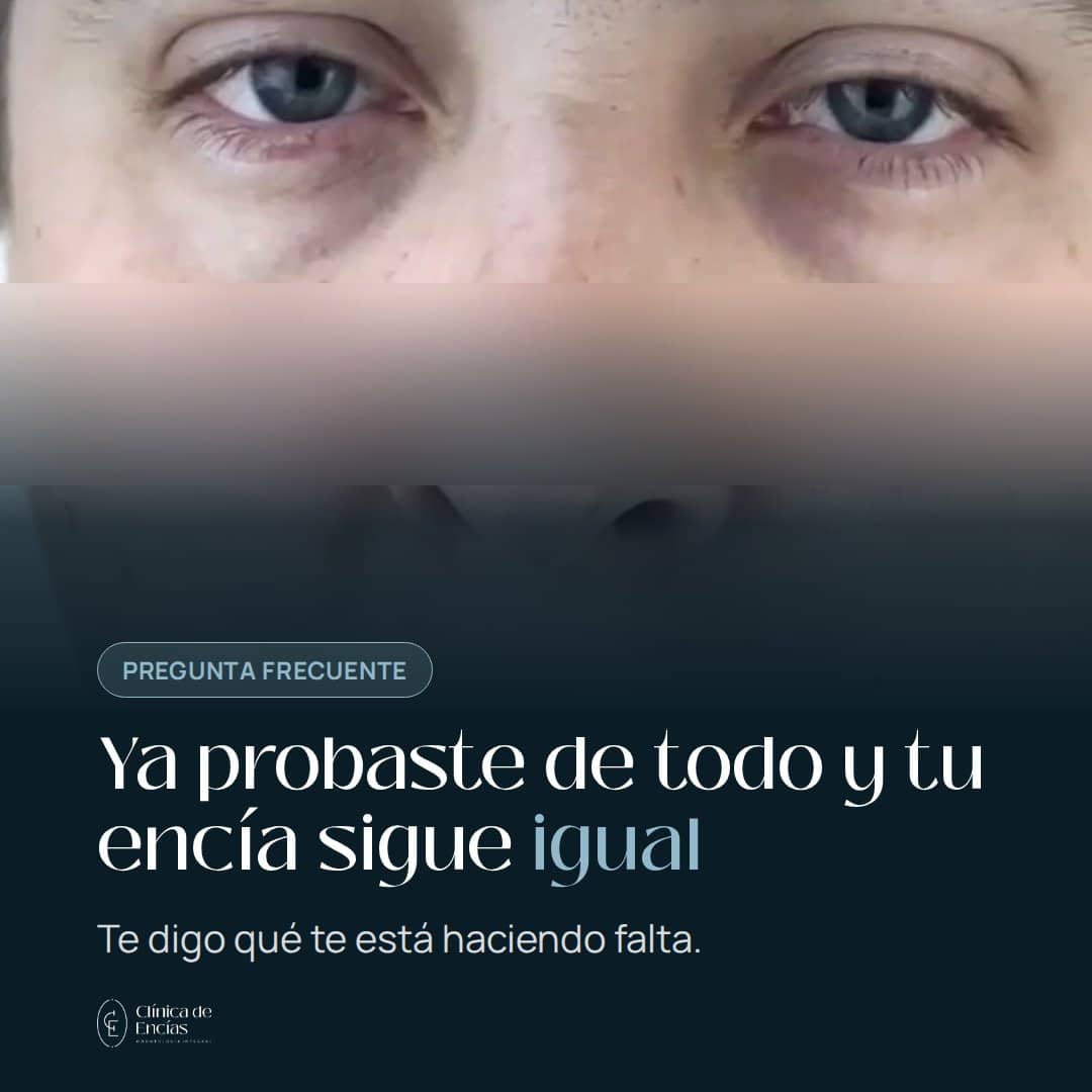 Ya probaste de todo y tu encía sigue igual