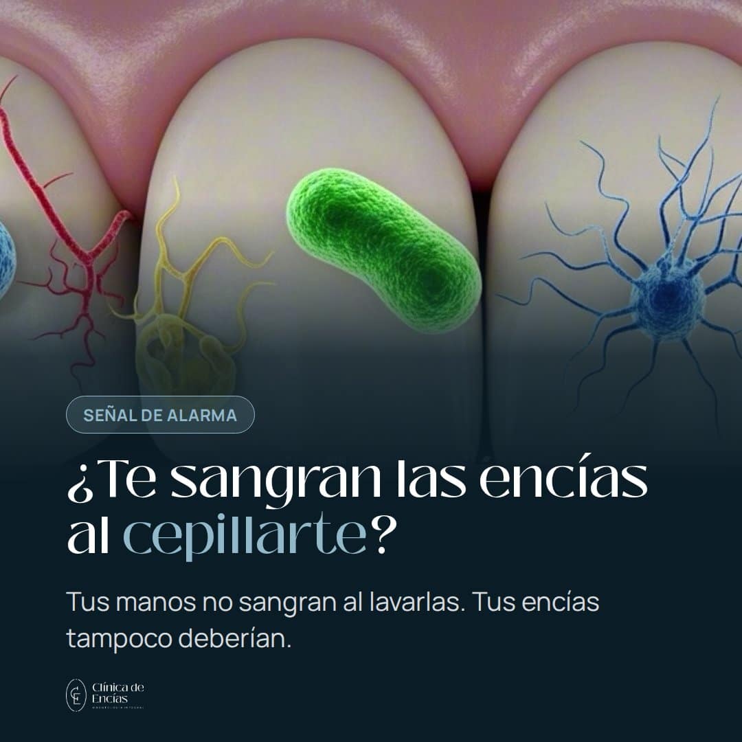 ¿Por qué me sangran las encías cuando me cepillo?