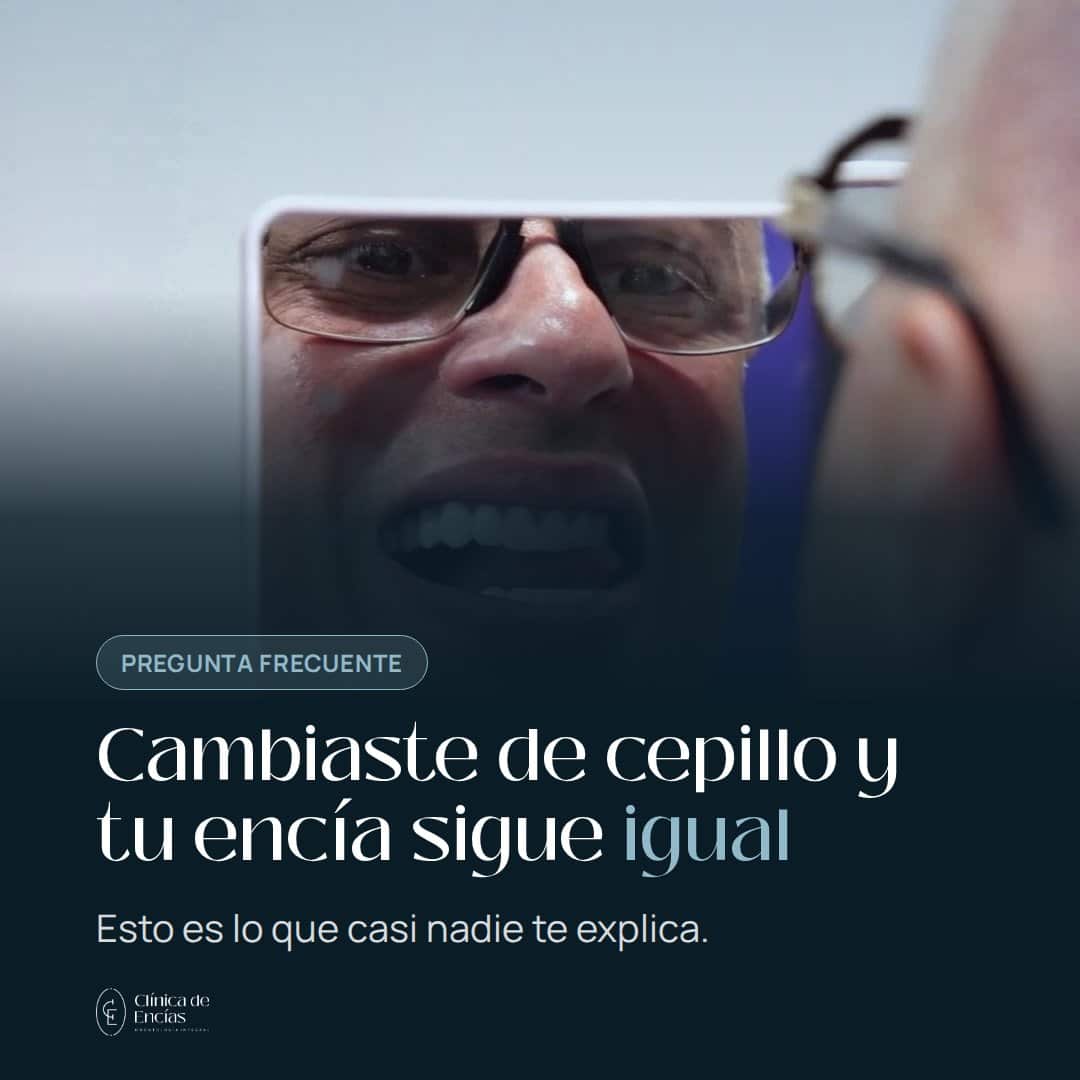 Cambiaste de cepillo y tu encía sigue igual