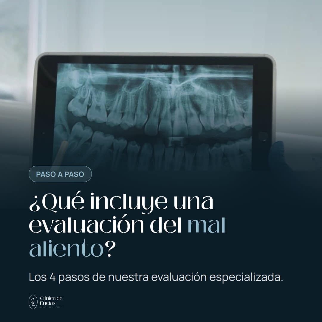 ¿Qué incluye una evaluación del mal aliento?